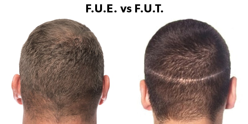 تفاوت fue و fut