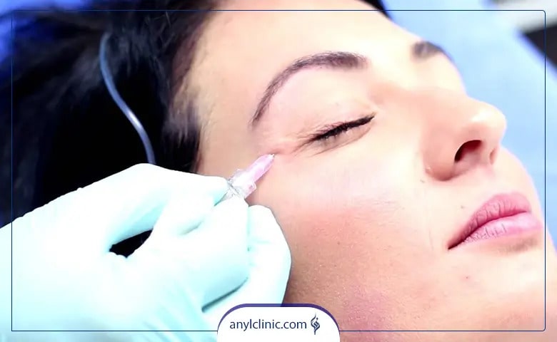 کربوکسی تراپی جای جوش چگونه است؟