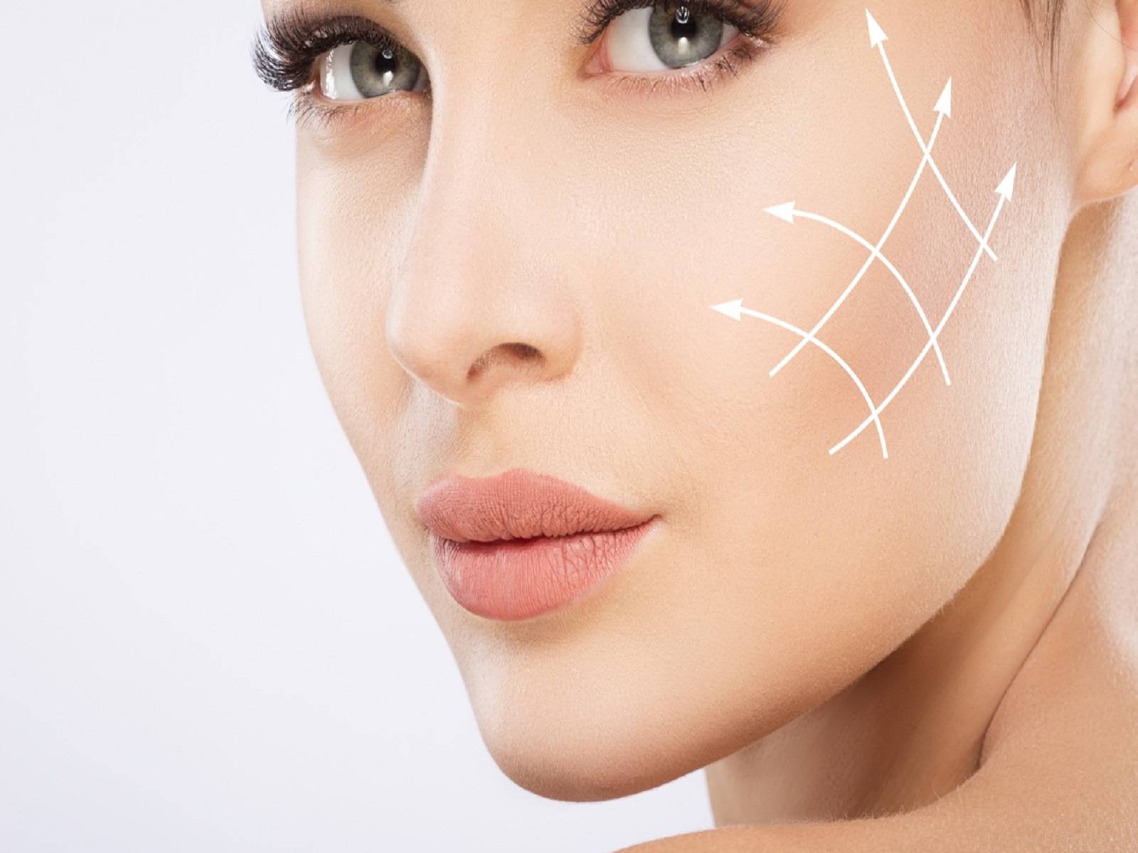 تزریق ژل به گونه و نکات آن