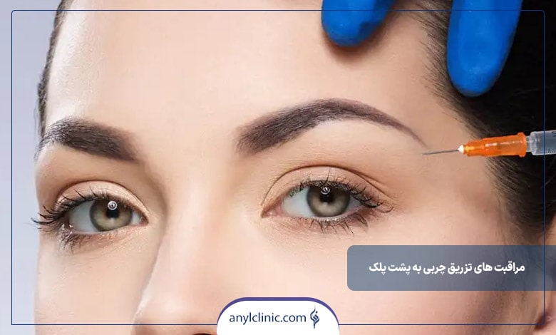 مراقبت های تزریق چربی به پشت پلک