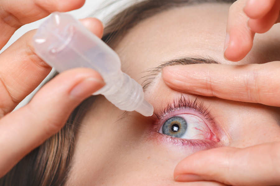 درمان بلفاریت چشم با قطره