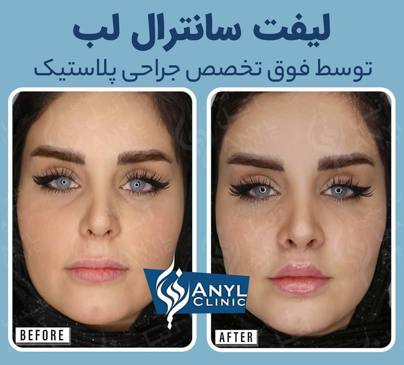 عمل سانترال لب