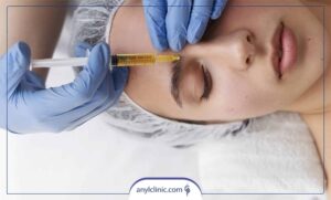 عوارض پی آر پی صورت چیست؟