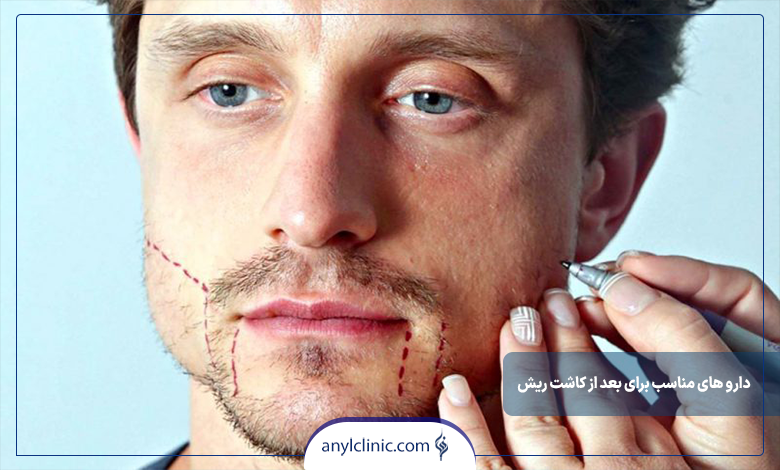 داروهای مناسب برای عوارض کاشت ریش