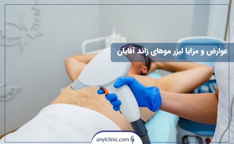 مزایا و عوارض لیزر بدن آقایان