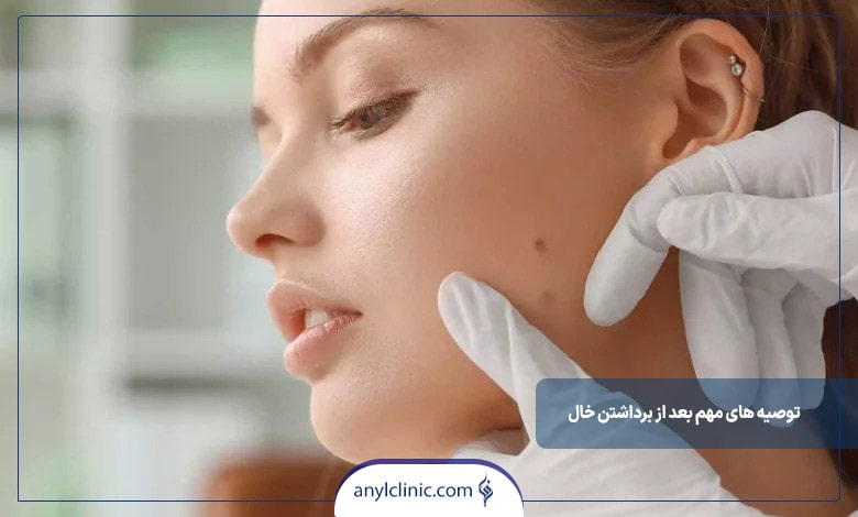 توصیه های مهم بعد از برداشتن خال