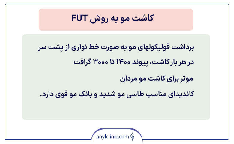 کاشت مو به روش fut