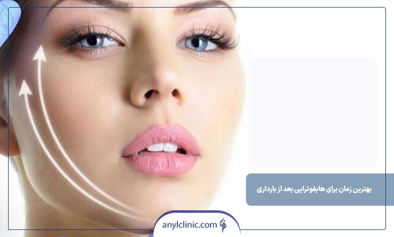 بهترین زمان برای هایفوتراپی بعد از بارداری