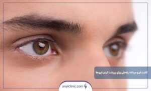 کاشت ابرو مردانه: راه‌حلی برای پرپشت کردن ابروها